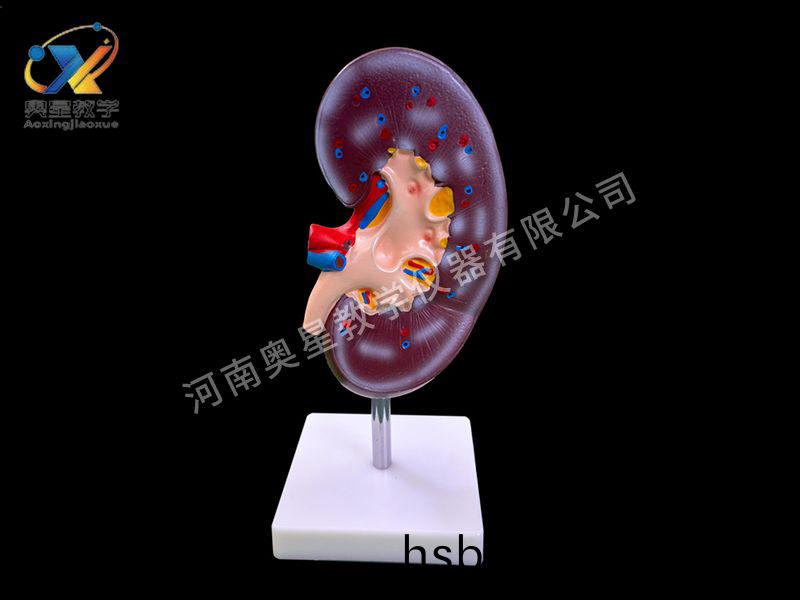 腎解剖糢型